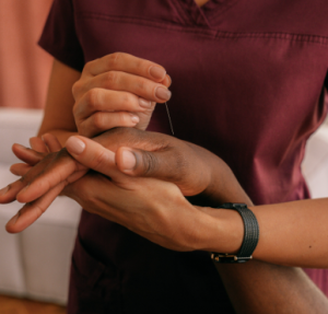 acupuncture insurance tx
